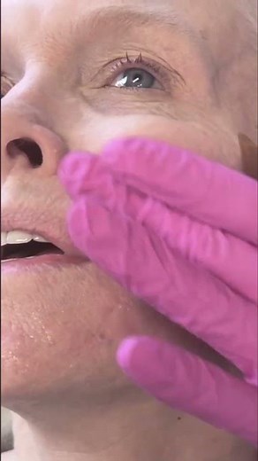 Skin Transformation @Puar.Medspa in Lake Mary. #Shorts