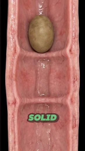 How Eosinophilic Esophagitis Can Make Food Get Stuck in the Esophagus | 3D Animation