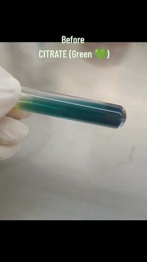 2.7K views · 39 reactions | Biochemical testing  citrate utilisation test #lablife | Lab life | Facebook