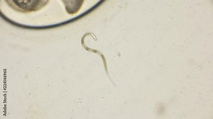 the nematode worm under a microscope Stock Video