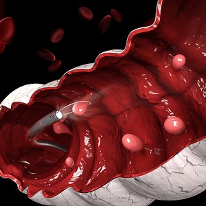 415K views · 3.3K reactions | 5 Signs of Intestinal Cancer that you should be aware of | Doctor ASKY | Facebook