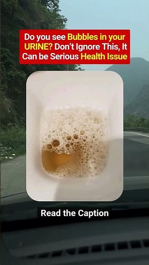 🚽 Do You See Bubbles in Your Urine?Don't Ignore It #UrineHealth #DiabetesCare #HealthAwareness