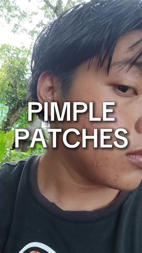 300 Effective Solutions for Pimples and Acne