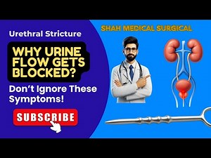 What is Urethral Stricture? Causes, Signs & Treatment Options| Everything You Need to Know| #Urology