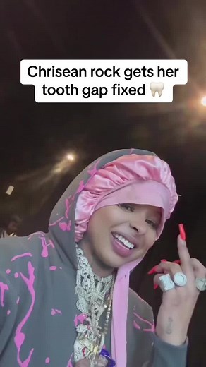 #chriseanrock gets her tooth gap fixed #viral #fyp