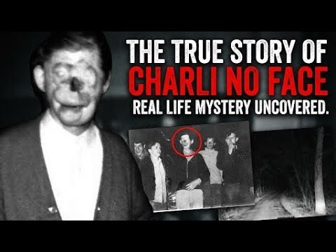 Charlie No-Face | Monster या इंसान? The Tragic Real Life Story of Raymond Robinson