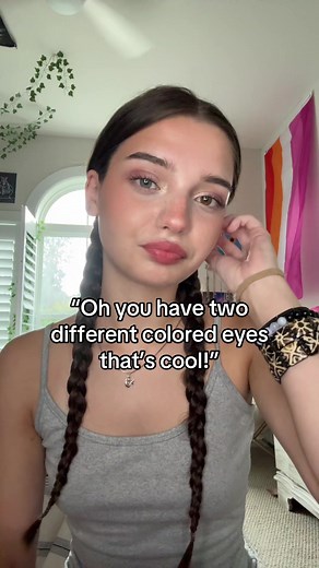 Understanding Heterochromia: Eye Color Differences Explained