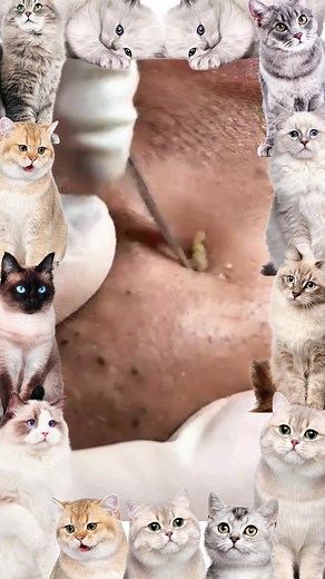 My god!!!😱💕#pimple #cyst #blackhead #USblackhead #cystpopping #fyp