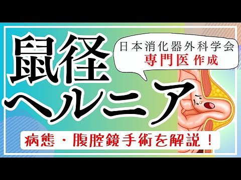 鼠径ヘルニアの腹腔鏡手術について / 辻仲病院柏の葉
