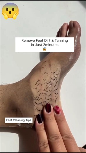 🫶Remover Feet Dirt & Tanning In 1 Ues/Clean All Dirt & Tanning | #shorts #ytshorts #feet #handcare