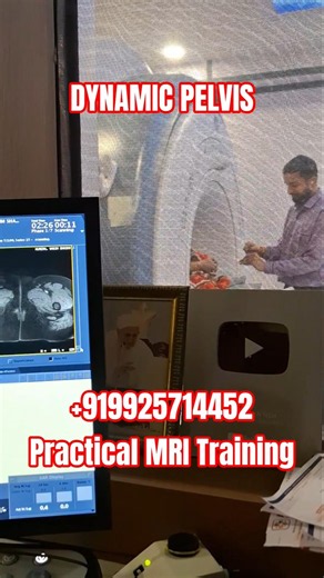 Dynamic Pelvis MRI Training #viral #shortsfeed #shorts #short #shortviral