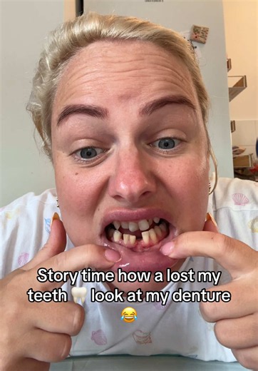 Am off to turkey 🇹🇷 next week a place ad say i didnt wanna go for teeth but here goes i cant wait now lets get a new smile 😃 ❤️#denture #newsmile #missingteeth #cantwait