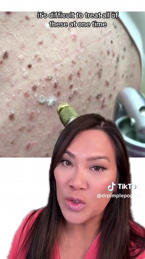 Barnacles on Human Skin: Risks, Removal, and Concerns