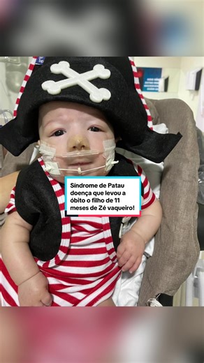 Síndrome de Patau: a triste história de Zé Vaqueiro