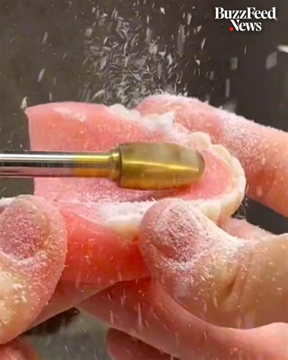 This woman shows the amazing process behind restoring people’s smiles ? | BuzzFeed