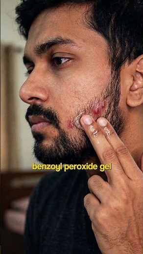 Stop Shaving Against the Grain! 🧔‍♂️🚫 #IngrownHair #BeardCare #ShavingTips #GroomingHacks