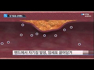 구글, 암 치료 도전...의료용 손목밴드 개발 / YTN 사이언스
