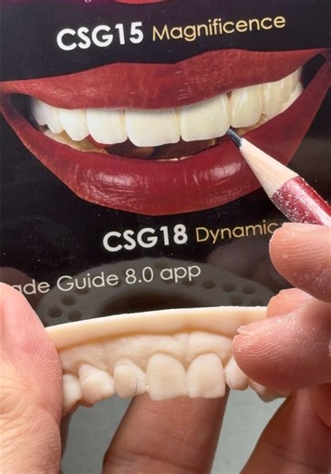 Hollywood Style Restoration for Dr. Angel Valezquez