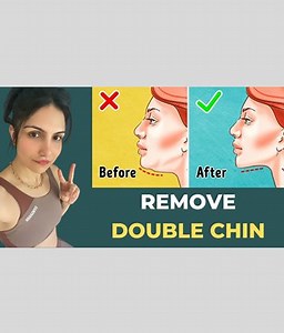 Super Easy Exercise to Remove Double Chin Instantly| डबल चिन कैसे काम करें Facial Yoga to get rid of Double Chin Double chin removal How to get rid of a double chin How to get rid of double chin Get rid of double chin Double chin exercises Double chin exercise Remove double chin How to remove double chin How to lose double chin Get rid of a double chin How do you get rid of a double chin Double chin exercises for women Organic Plant Based Collagen https://palaknotes.com/products/beauty-care-orga