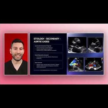 Primary vs Secondary Causes of Aortic Regurgitation Explained
