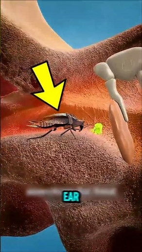If a Cockroach Crawls Inside Your Ears... Don’t Stick Your Finger In!