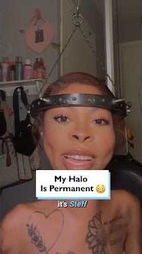 Why my halo is PERMANENT 🏥😳 #Scoliosis #HaloBrace #MedicalStorytime