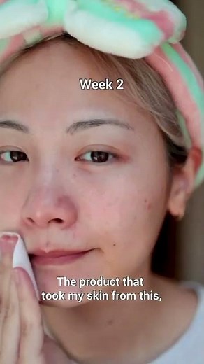 Medicube Zero Pore Pad 2.0 Review | Best Korean Toner Pads