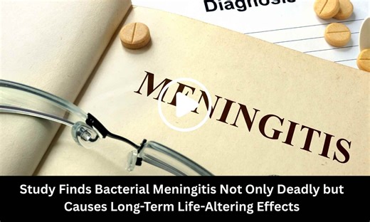 Bacterial Meningitis Survivors Face Long-Term Neurological and Psychological Sequelae: Study