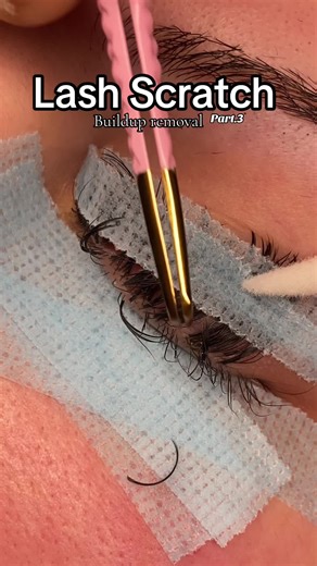 Lash Scratch Techniques: Effective Buildup Removal Part 3
