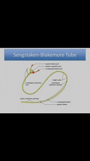 Sengstaken–Blakemore tube