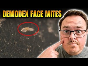 CAN'T UNSEE!! Finding FACE MITES with my compound MICROSCOPE