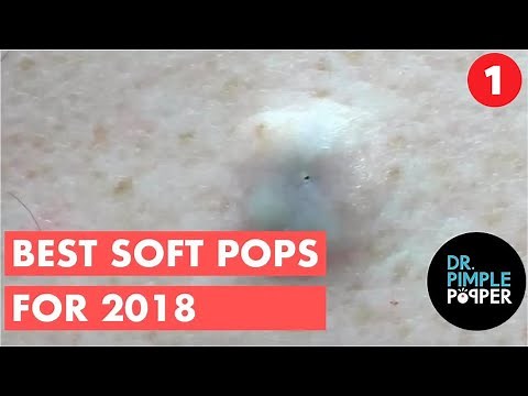 The BEST OF Softpops 2015 for 2018 Part 1! Dr Pimple Popper