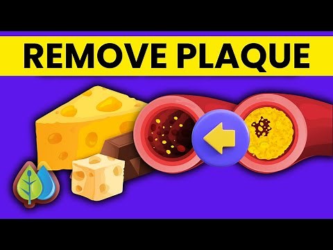 7 Nutrients To Remove Calcium Plaque From Your Arteries
