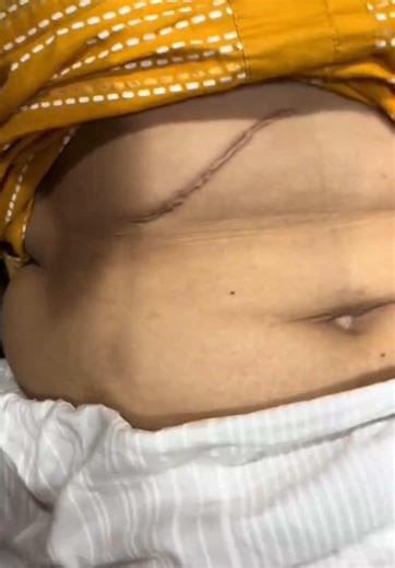 Stunning Scar Cover-Up Techniques by Tattoo Artists