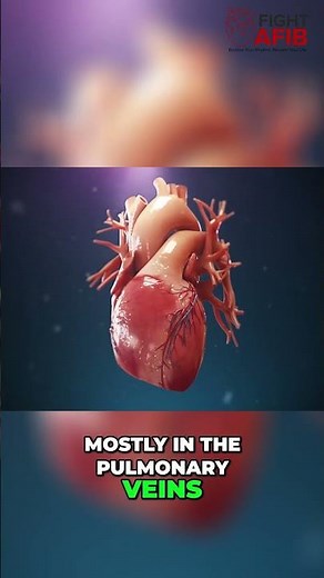 Paroxysmal vs Persistent AFib: Which One Are You?