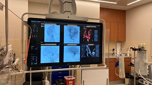 New equipment at Riverbend Hospital helping stroke patients