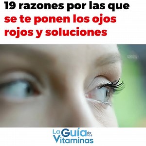 19 razones por las que se te ponen los ojos rojos y soluciones | Guía de Las Vitaminas