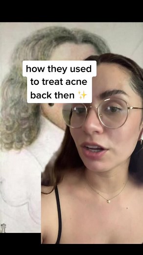 #stitch with @clearstart here’s how they used to treat acne back then ✨ #acneskin #18thcentury #skincare #pimplepatches