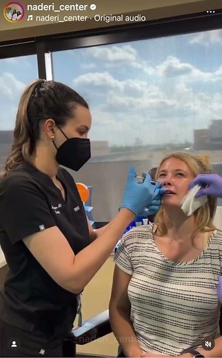 Eliminate Dark Circles: Tear Trough Correction Before & After