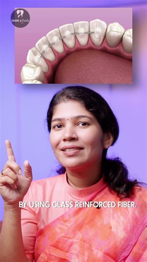 Fixed Retainer After Braces : Essential or Optional? #retainer #smilecorrection