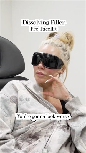 Dissolving ‪@BunnieXo‬ Fillers, Pre-Facelift| Dr. Gould Plastic Surgery #beverlyhillsplasticsurgery