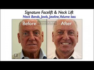 What happens in a neck lift? Animation of a neck lift procedure.