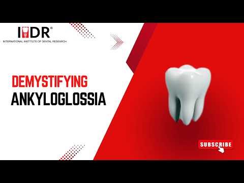 Demystifying Ankyloglossia