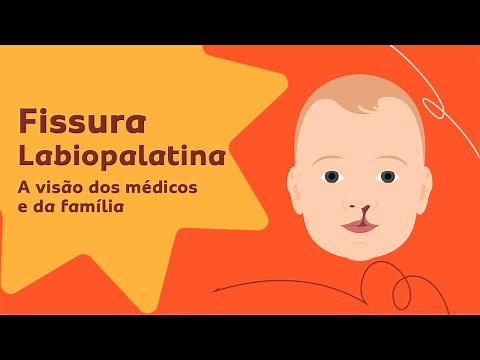 Fissura Labiopalatina: A Importância do Tratamento Multidisciplinar