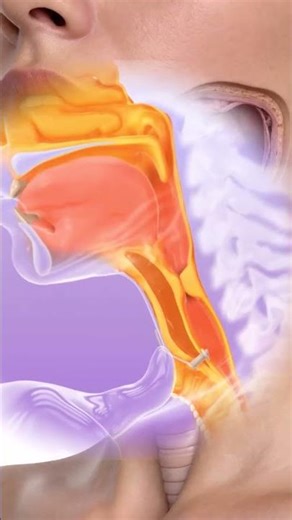 🎙️: Laryngectomy Surgery and Speech Rehabilitation