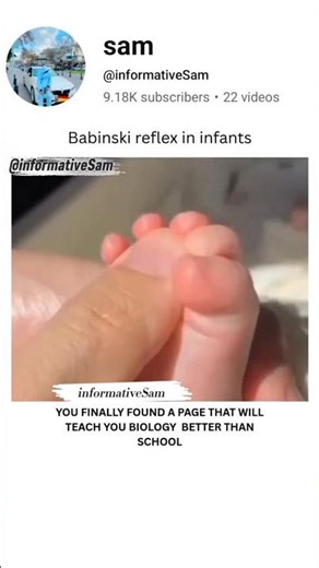 Why new born babies catch your hands | reflex #brainlearning #biologyscience #medicaleducation