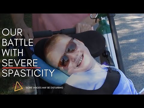 Bryson's severe spasticity/dystonia (raw footage) and how we manage it
