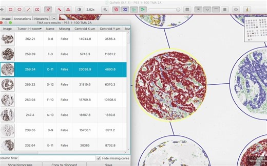qupath for tma