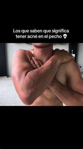 Los que saben 💀💀💀 | acne