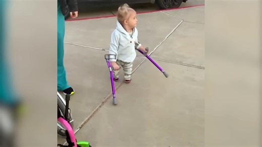 Five-year-old girl born with "mermaid syndrome" has taken her first steps after surgery